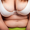 Pendulous breasts