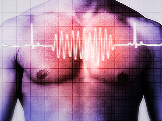 Standard 12-Lead Electrocardiogram